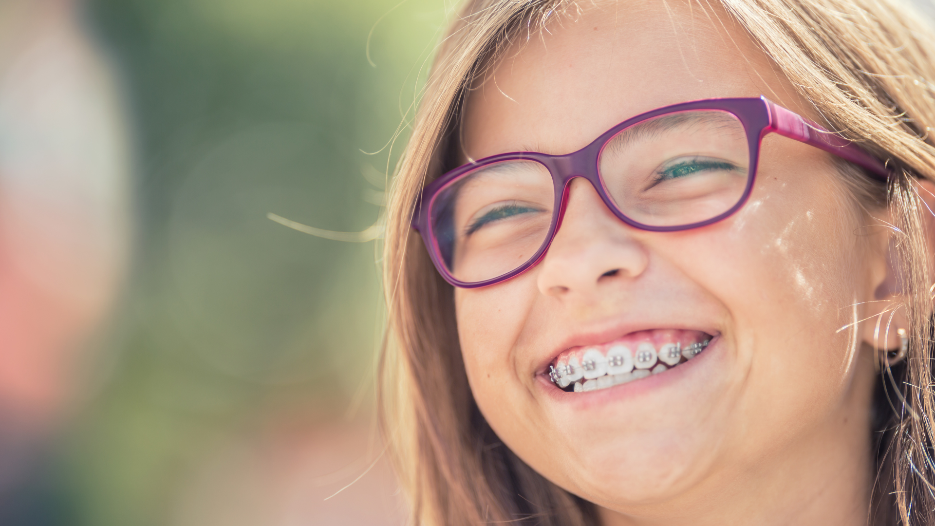 Braces for a straighter smile - JB Dental Associates