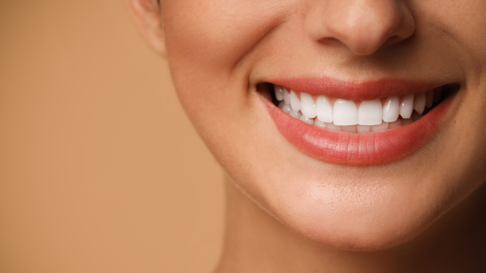 Dental Bonding in Sterling VA