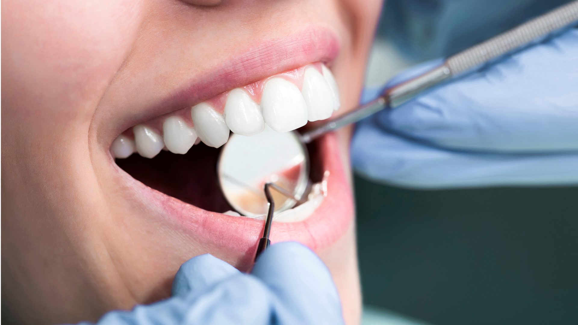 Dental Crown Treatment | Sterling VA