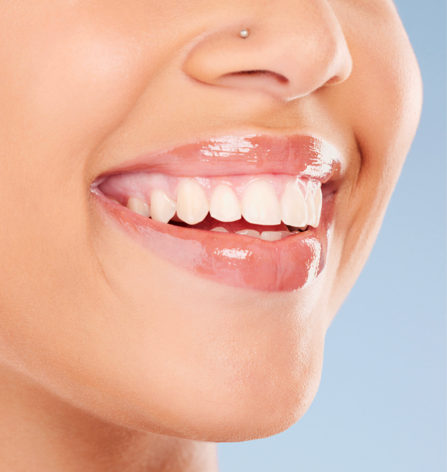 Dental Veneers - Sterling VA get the smile you love!