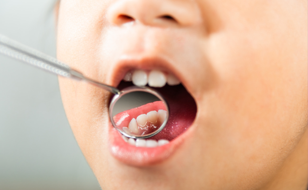 Pediatric Dentist In Sterling VA - Your Trusted Kids Dentist