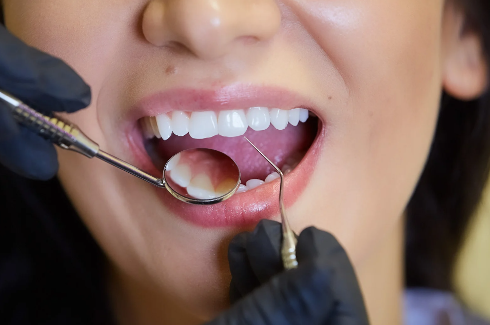 Sedation Dentistry to help reduce anxiety visiting the dentist