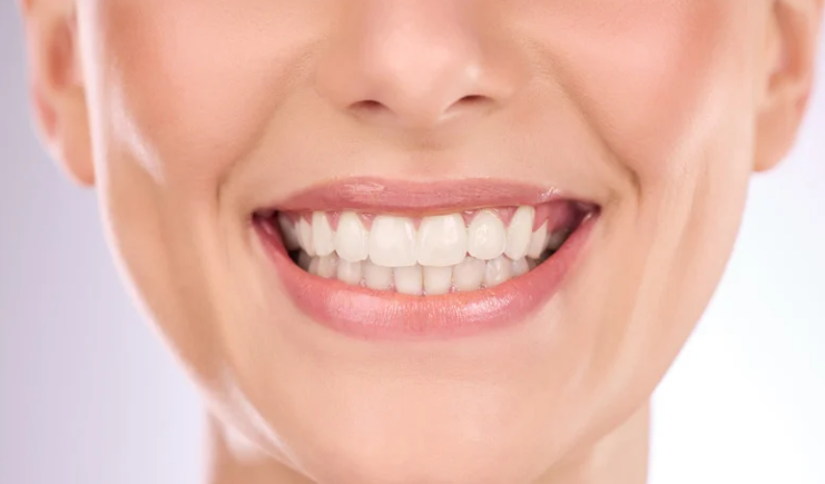 Get the hollywood smile - Teeth whitening in sterling va