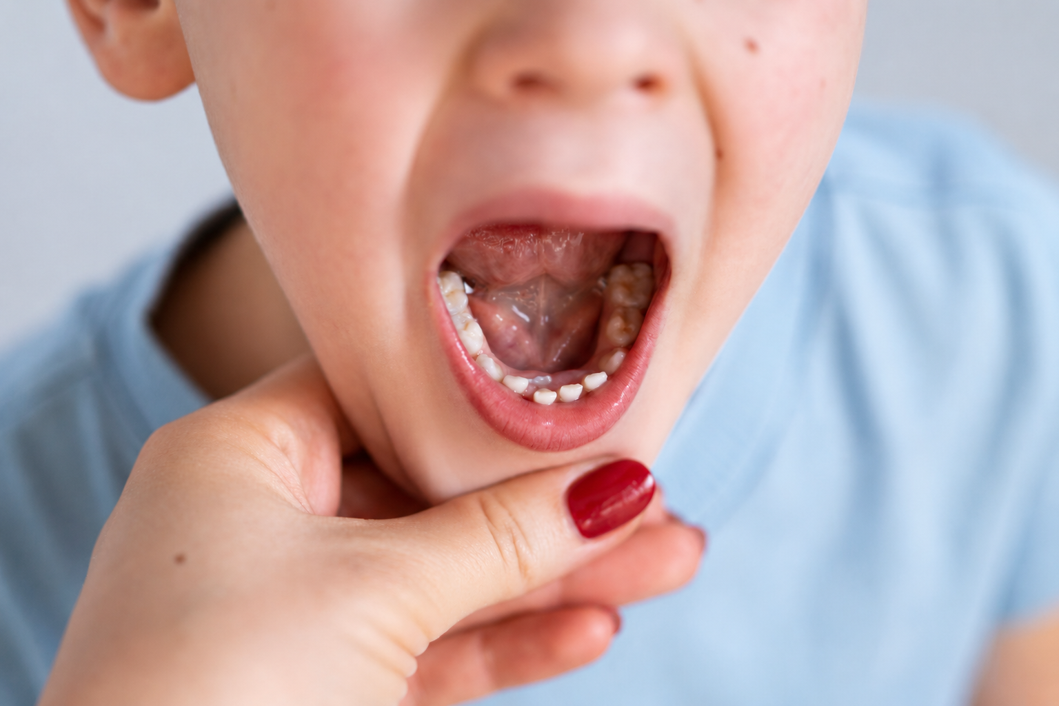 tongue tie treatment in Sterling VA