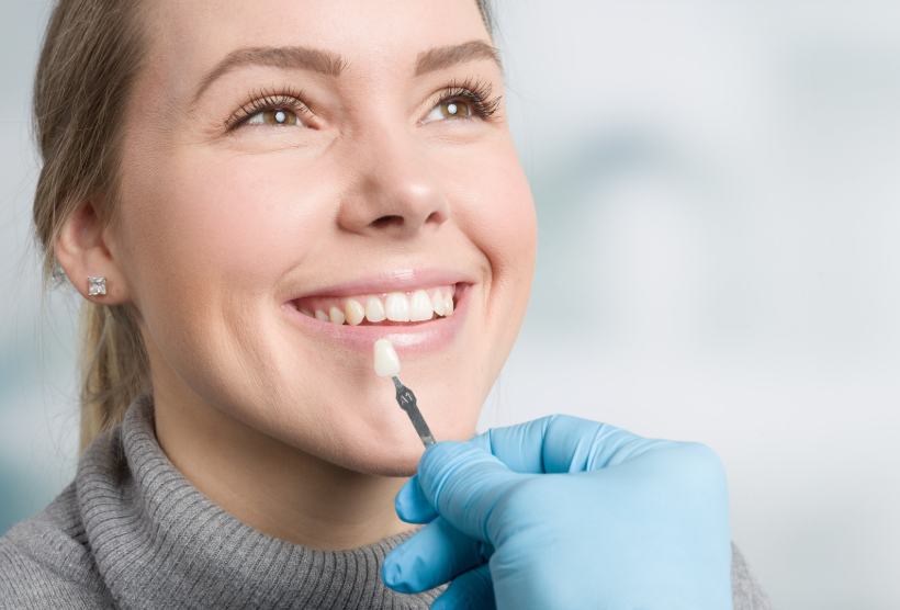 Veneers by JB Dental Associates in Sterling Va