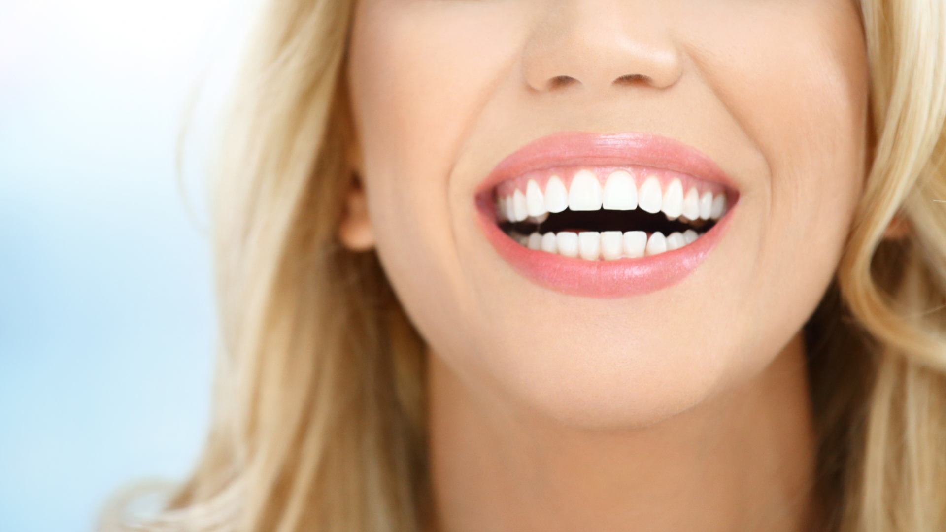 Amazing Veneers in Sterling VA