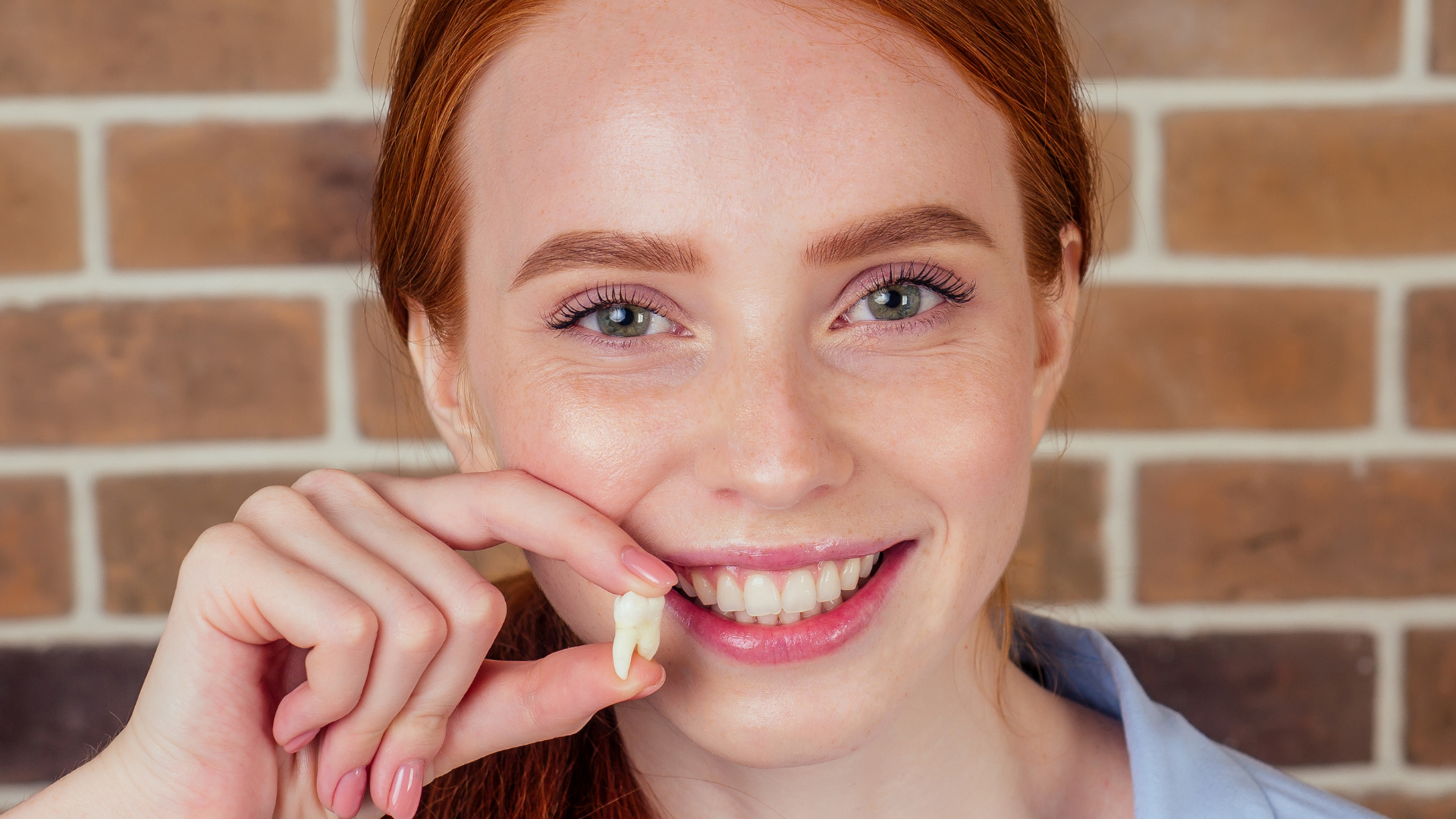 Gentle Wisdom Teeth Removal - JB Dental Associates